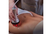 Lipo Láser de baja intensidad en Los Angeles