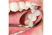 DENTISTA PARA NIÑOS thumbnail