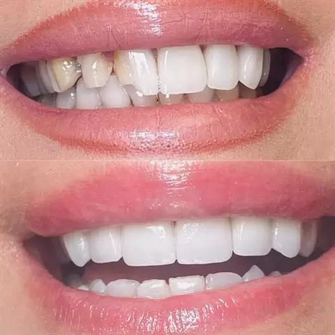 Selfie Smiles Dental Group image 3