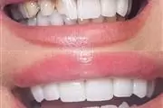 Selfie Smiles Dental Group thumbnail 3