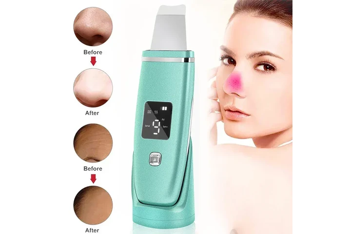 Ultrasonic Blackhead Remover image 3