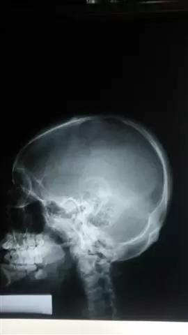 RADIOGRAFIAS A DOMICILIO image 4