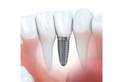 Modern Dentistry Canberra en Australia