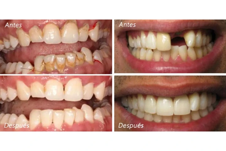 DENTISTA FAMILIAR EN VISTA image 2