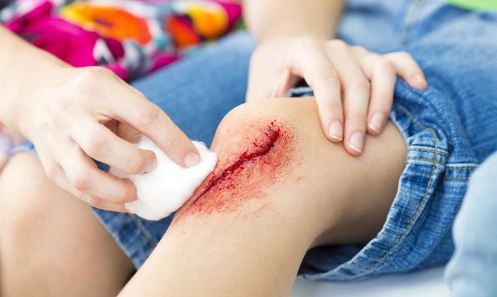 Mujer limpiando una herida de su hijo