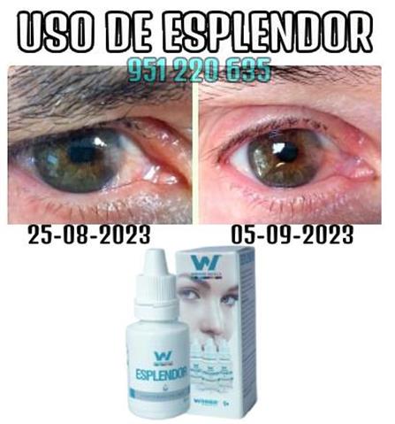 Esplendor Salud Visual Regener image 2