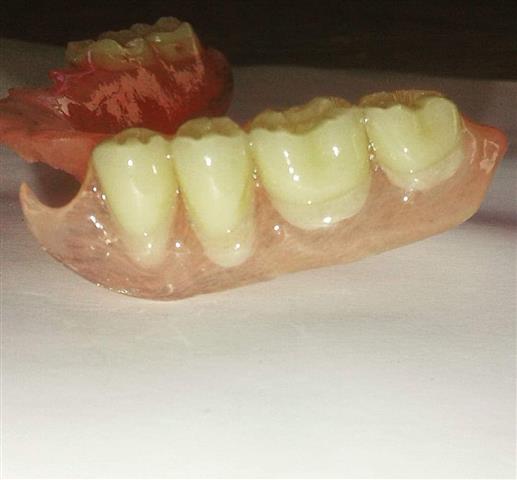 Laboratorio dental Osmart image 9