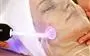 ACNE FACIAL LIMPIEZA PRODUNDA thumbnail