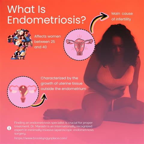 Endometriosis specialists image 2