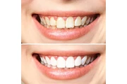 Atención dental de calidad🦷 en Orange County