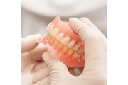 Implantes Dentales en Los Angeles