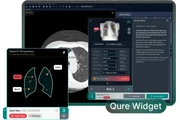 AI Detection & Follow-Up thumbnail