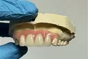 Dentaduras, parciales, coronas thumbnail