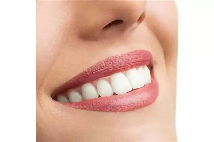 Dentista Cosmético image 3