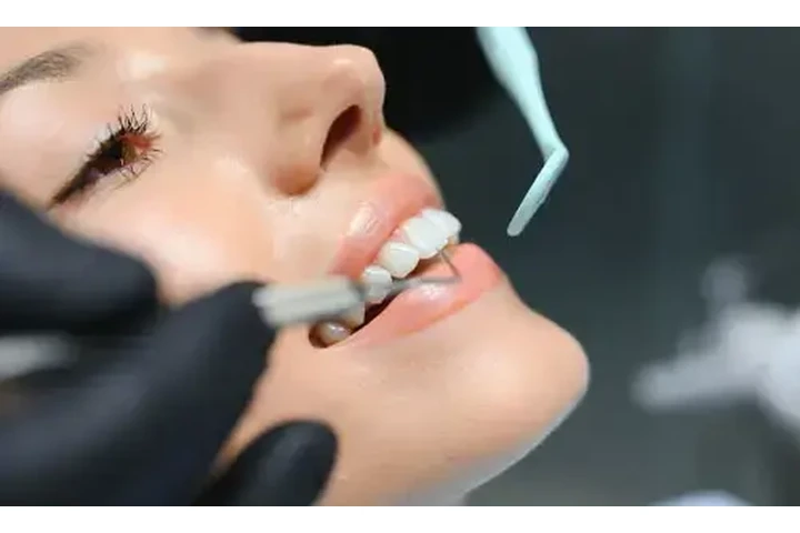 Implantes dentales desde $1999 image 2