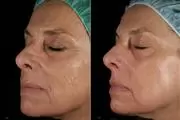 Skin Care 01/09/2023 en Fort Lauderdale