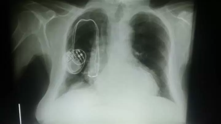 RADIOGRAFIAS A DOMICILIO image 2