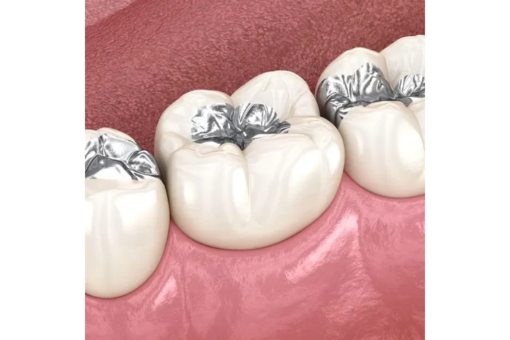 Dentista económico en Lynwood image 5