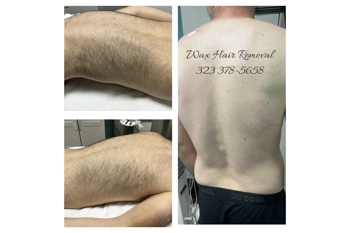 DEPILACION PARA HOMBRE/MUJER image 8