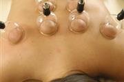 BIOMAGNETISMO CUPPING DOLORES thumbnail