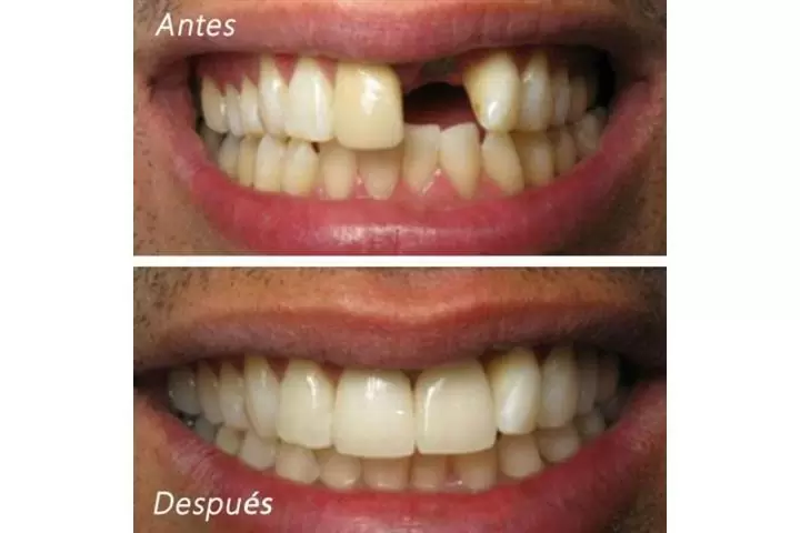 DENTISTA FAMILIAR EN VISTA image 1