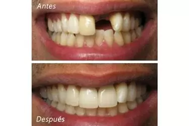 DENTISTA FAMILIAR EN VISTA en San Diego