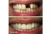 DENTISTA FAMILIAR EN VISTA en San Diego
