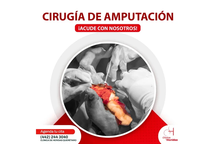 ¿Herida que no mejora? image 1