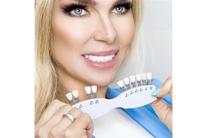 Dentista Cosmético image 4