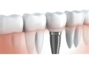 DENTISTA PARA LA FAMILIA en Los Angeles