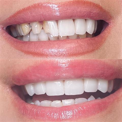 Healthy Smiles, Happy Life! image 2