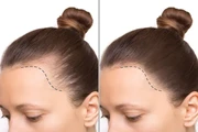 Hairline Tattoo en Seattle
