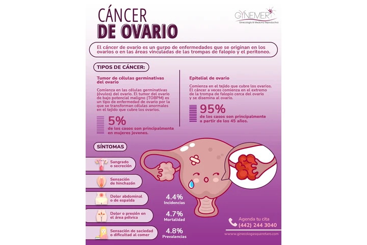 Detecta el cáncer de ovar image 1