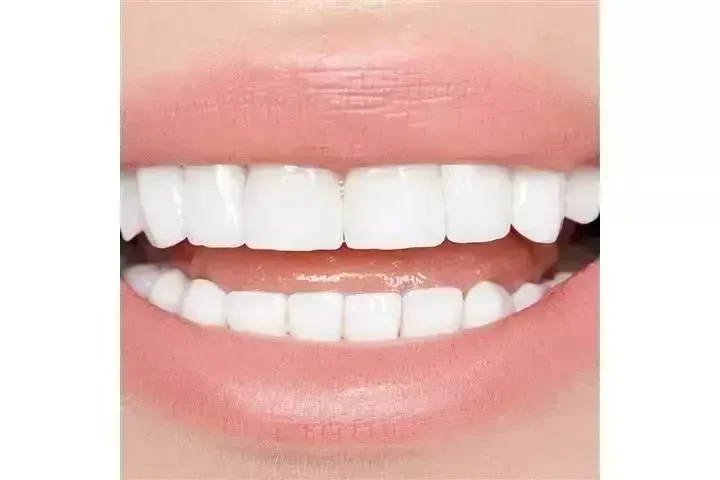 Implantes Dentales desde $799 image 4