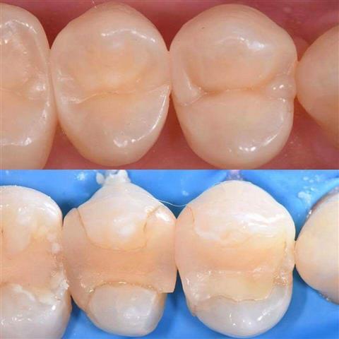 Dental Vela image 10