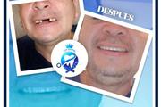 Dentista Familiar a bajo costo thumbnail