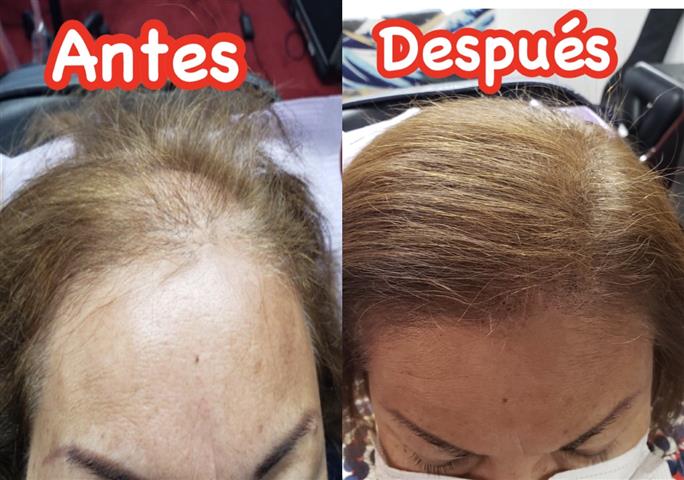 The Better Scalp image 1