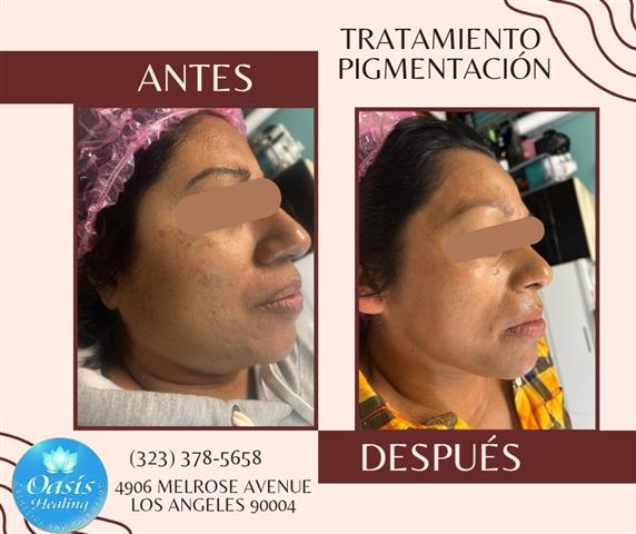 MODELOS PARA FACIAL GRATIS image 6