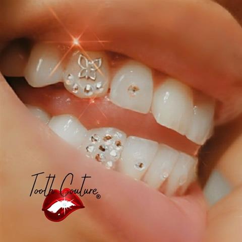 Tooth Couture image 1