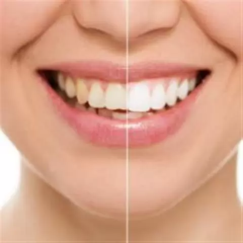 Oasis Smiles image 4