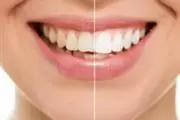 Oasis Smiles thumbnail 4