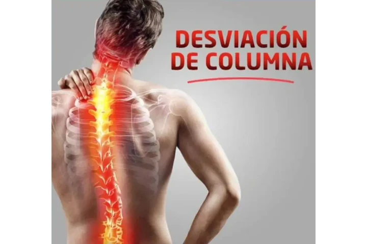 Quiropráctica para la salud image 8