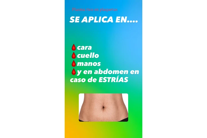 Plasma rico en plaquetas image 7