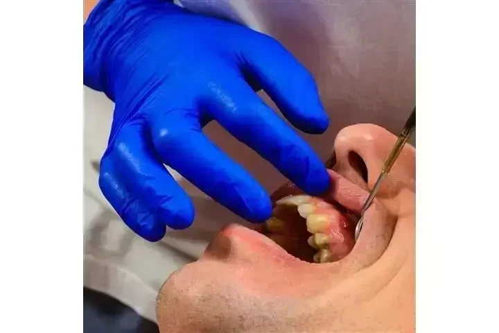 Implantes Dentales desde $799 image 6