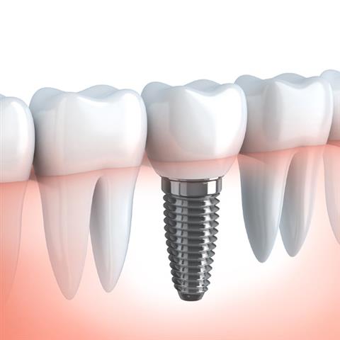SmileOne Dentistry image 1