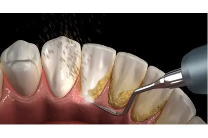 DENTISTA GENERAL FAMILIAR image 5