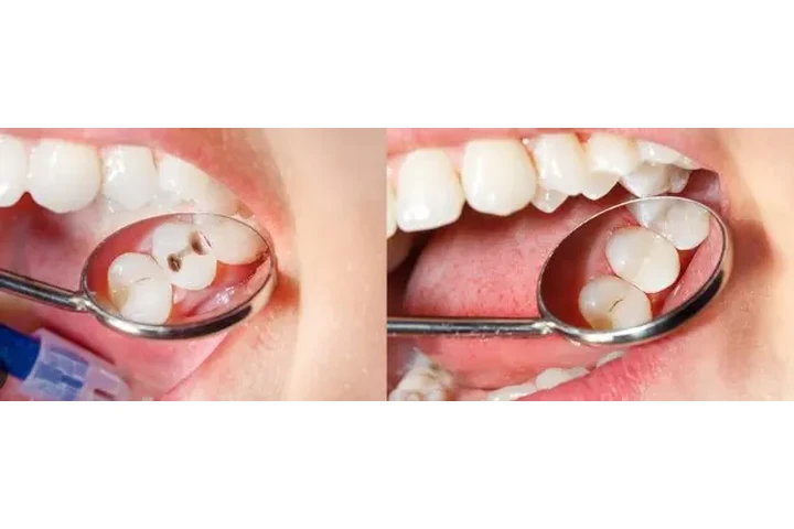 DENTISTA GENERAL FAMILIAR image 2
