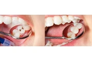 DENTISTA GENERAL FAMILIAR thumbnail