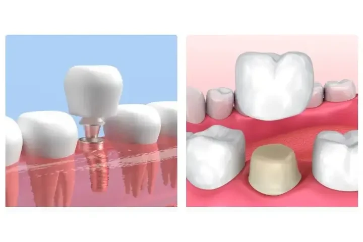Dentista general y cosmético image 2
