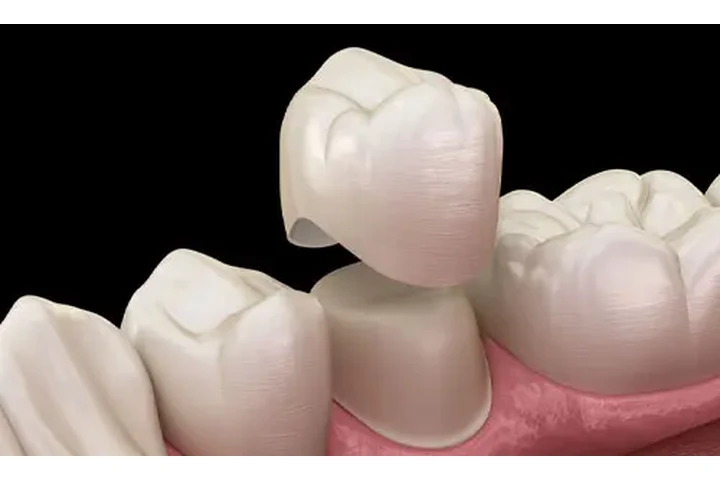 Clínica Dental Económica image 6